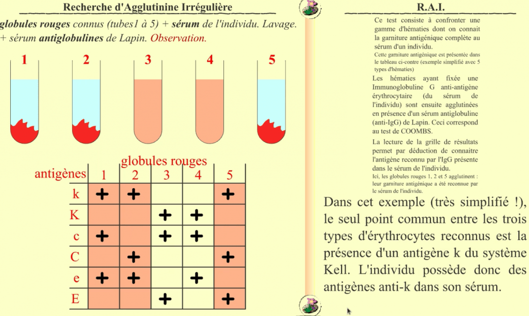 Groupe Sanguin Le Plus Répandu En France